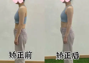 小孩儿驼背的康复训练技术与效果评估体系构建